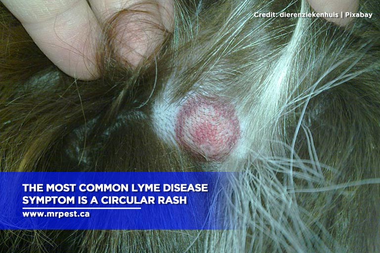 The most common Lyme disease symptom is a circular rash
