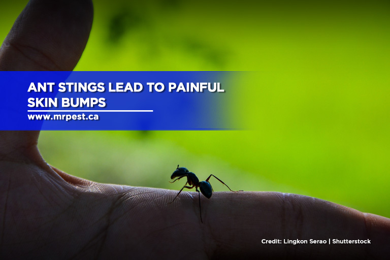 Ant stings lead to painful skin bumps