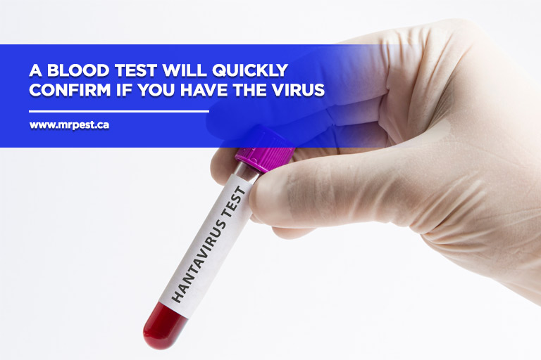 A blood test will quickly confirm if you have the virus