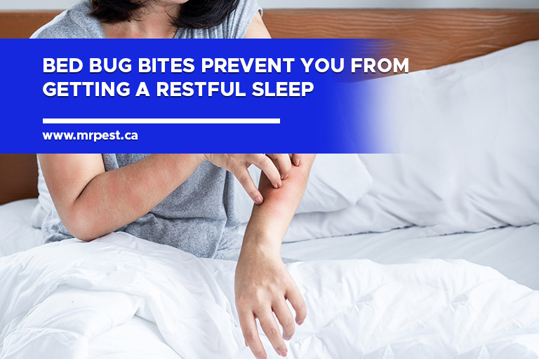 Bed bug bites prevent you from getting a restful sleep
