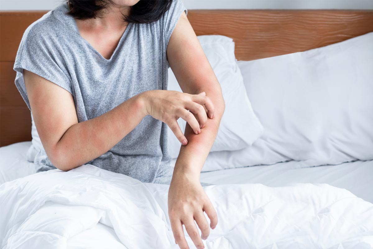 Why-Bed-Bugs-Are-a-Growing-Concern